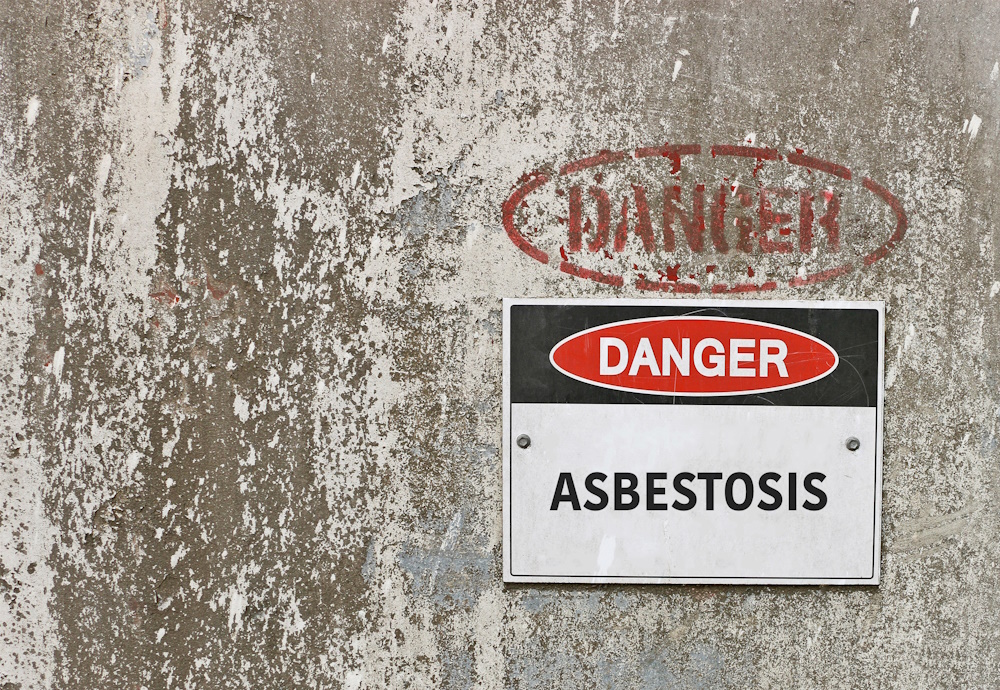 Navigating the Maze of an Asbestos Mesothelioma Lawsuit